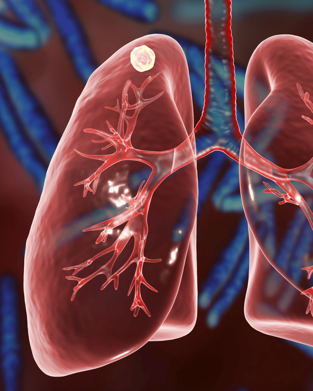 Lung disease
